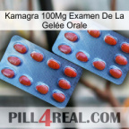 Kamagra 100Mg Examen De La Gelée Orale 05